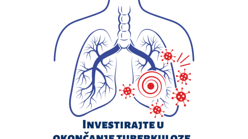 Crveni križ FBiH: Tuberkuloza ostaje jedan od najsmrtonosnijih zaraznih ubica na svijetu