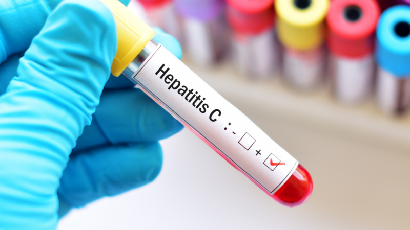 Zdravstveni savjet Općine Ilidža organizuje besplatno testiranje na hepatitis B i C