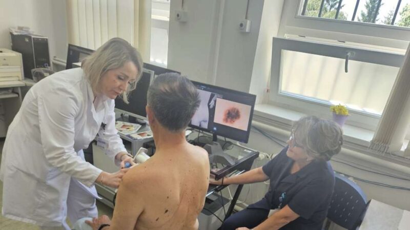 KCUS: Tokom besplatnih dermatoloških pregleda otkriveno pet melanoma
